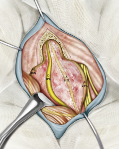 Vestibular